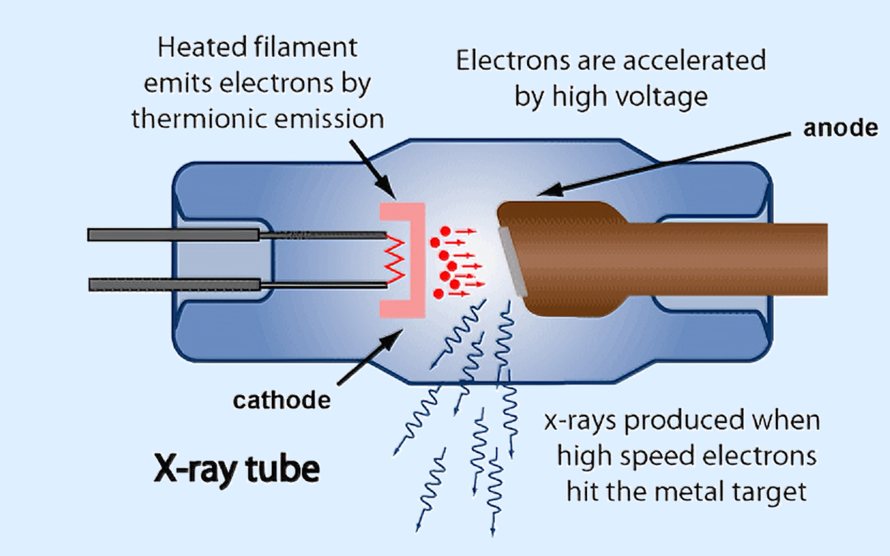 2. What X-ray Technology Actually Does 2. Jakie właściwie działanie ma technologia rentgenowska